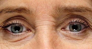 A Second Skin That Gives You the Elasticity of Youth