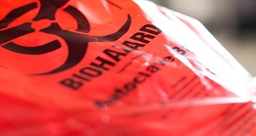 How Is Fat Disposed of After Liposuction?