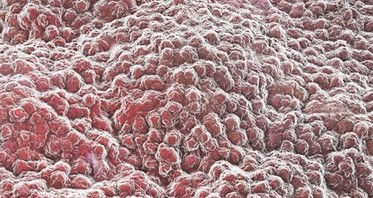 In-Depth: Gut Microbiome and Obesity