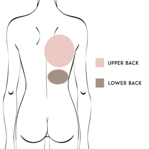 Back Liposuction