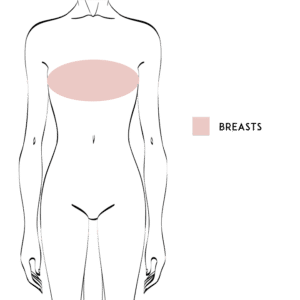 Female Breast Liposuction (Breast Reduction)