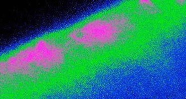 Groundbreaking Study Into Cells That Control Our Appetite Brings New Approaches In Treating Obesity