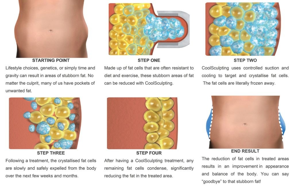 fat pad above belly button