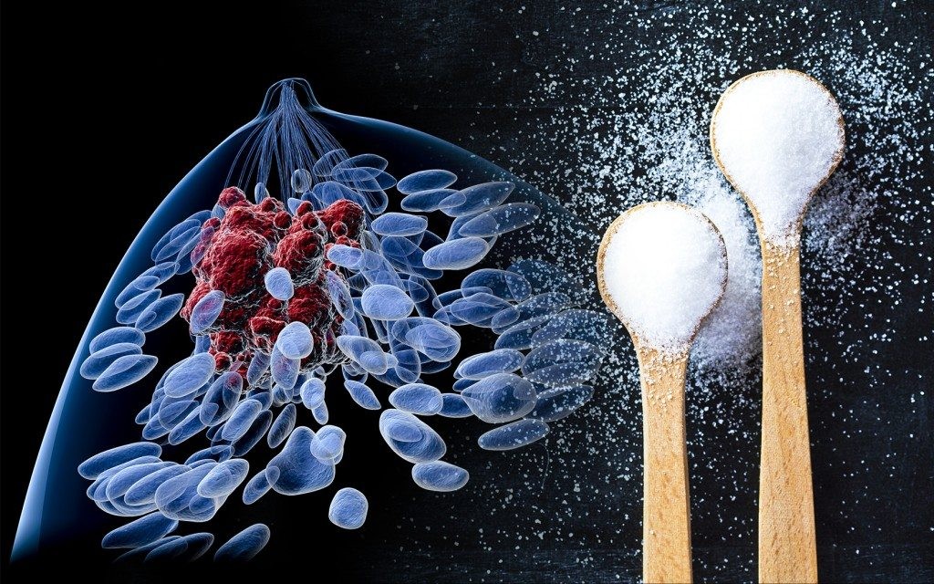 Study links high sugar intake to increased breast cancer risk