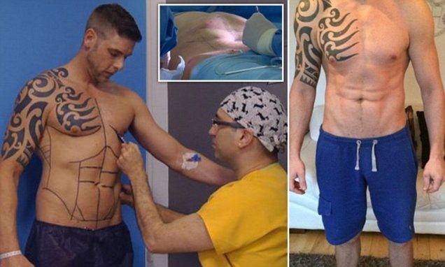 How to get a summer hot bod in two days: Tattoo a six-pack on your abdomen