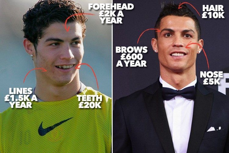 Footballers who have had their teeth fixed, including Cristiano