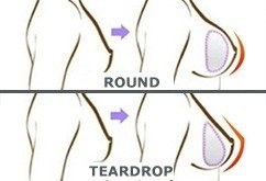 Round vs tear drop shape