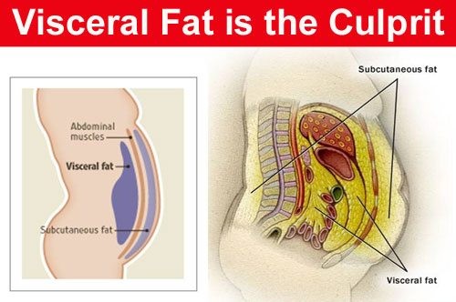 Visceral fat culprit