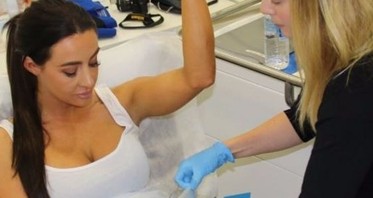 Does Coolsculpting Work? See Our Best Before & After Pictures