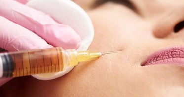 3 Unexpected Reasons to Consider Anti-Wrinkle Injections