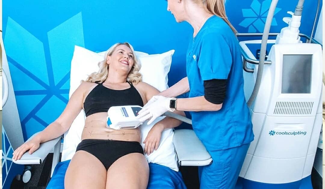 CoolSculpting in Action