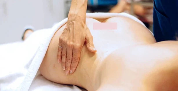 Male Fat Transfer to Buttocks (Brazilian Butt Lift or BBL) at Cosmos Clinic