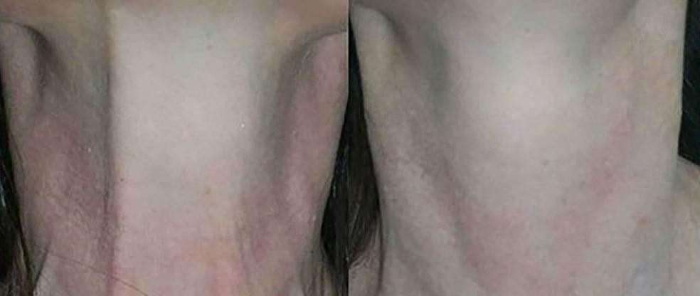 Neck Bands Pre2024 Before And After