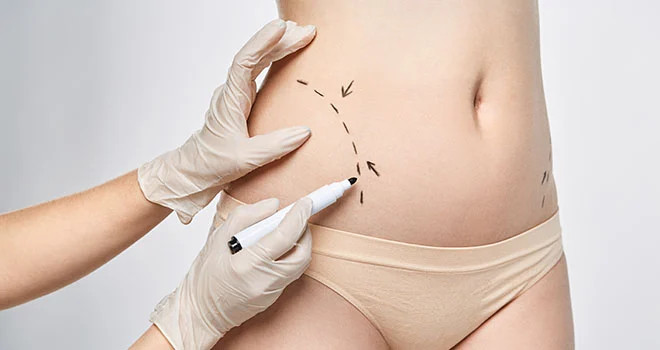 Consultations for elective cosmetic concerns
